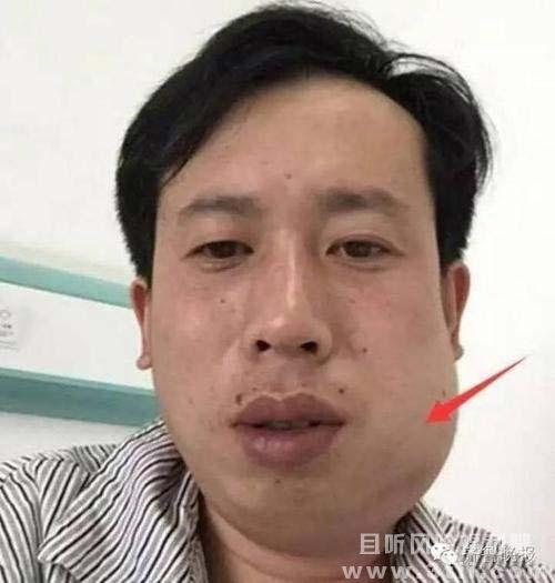 700根皮筋勒西瓜