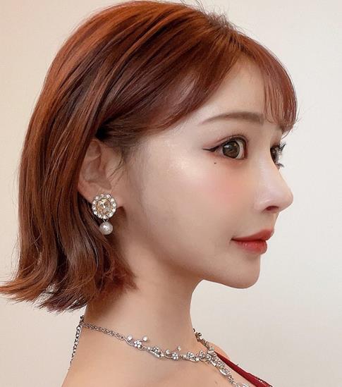 图片[3] - 明日花绮罗（明日花キララ）整形变美的代价？ - 壹悠家