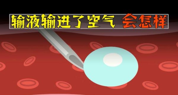 输液的时候，如果不小心输入了空气会怎样？ - 壹悠家