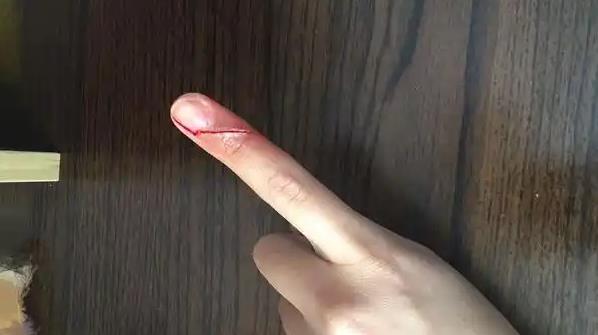 为什么手指被纸片割伤，比刀子划伤还要痛？ - 壹悠家